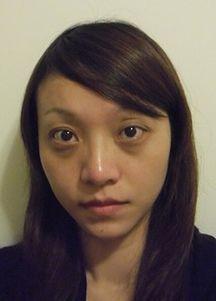 眼袋严重照片,揭秘眼袋成因与改善之道