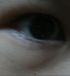 眼袋严重照片,揭秘眼袋成因与改善之道