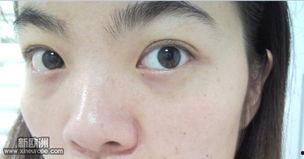 眼袋严重照片,揭秘眼袋成因与改善之道